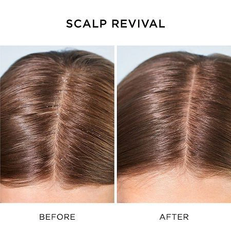 Wella SP Clear Scalp Shampoo 250ml képe 2